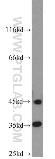 [16984-1-AP-20UL] PHYHIP Polyclonal antibody
