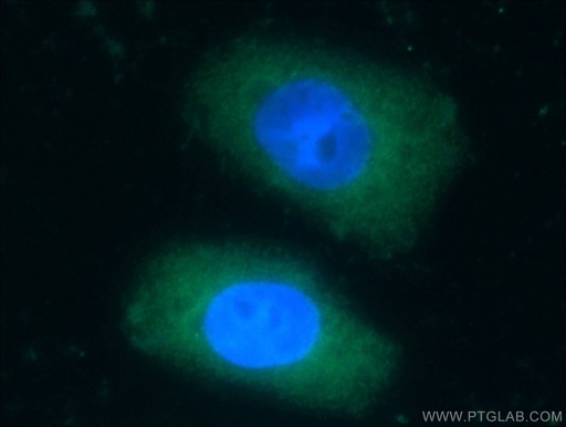 [16985-1-AP-20UL] KCNJ3 Polyclonal antibody