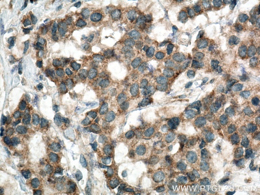 [16988-1-AP-20UL] HSDL1 Polyclonal antibody