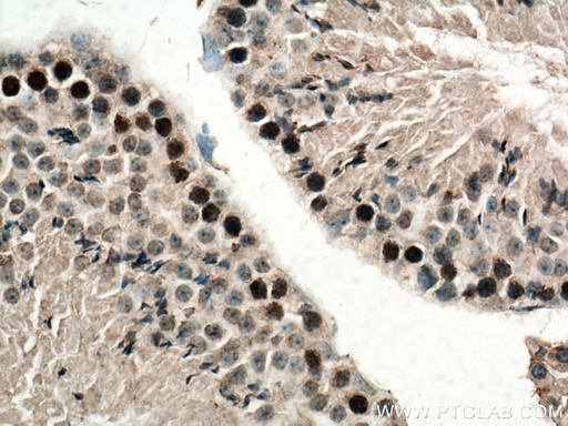 [16989-1-AP-20UL] SPATA22 Polyclonal antibody