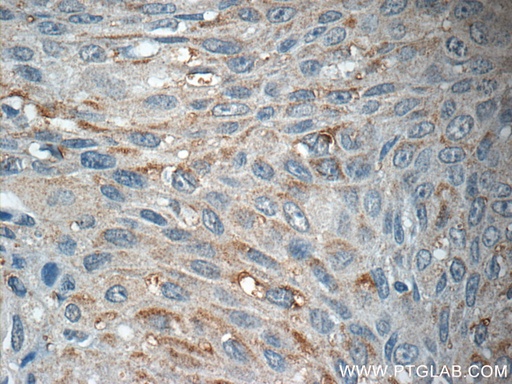 [16990-1-AP-20UL] AGBL3 Polyclonal antibody