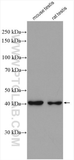 [16992-1-AP-20UL] ACTRT2 Polyclonal antibody