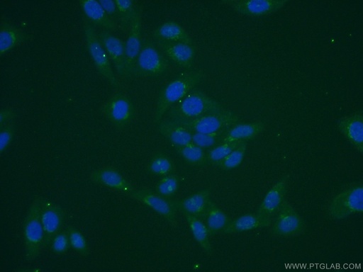 [16993-1-AP-150UL] MGAT5B Polyclonal antibody