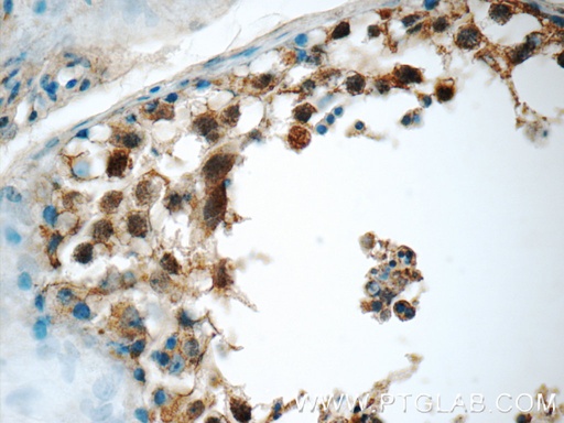 [16994-1-AP-20UL] SCAPER Polyclonal antibody