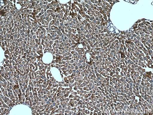 [17001-1-AP-150UL] METTL7B Polyclonal antibody