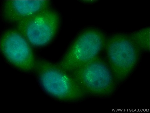 [17002-1-AP-20UL] TBC1D23 Polyclonal antibody