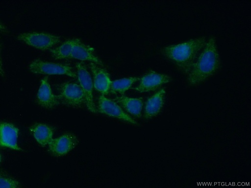 [17004-1-AP-20UL] HPD Polyclonal antibody