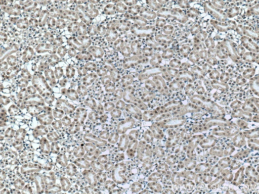 [17005-1-AP-150UL] UCKL1 Polyclonal antibody