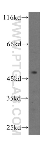 [17007-1-AP-150UL] CENPL Polyclonal antibody
