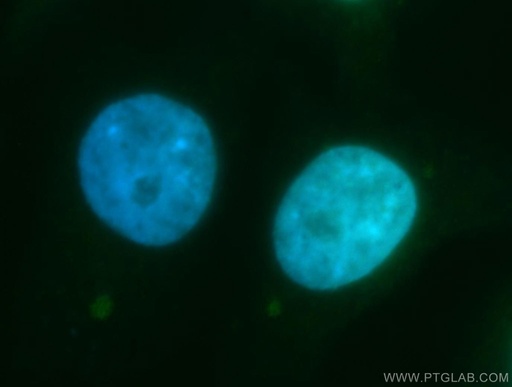 [17008-1-AP-20UL] RECQL4 Polyclonal antibody