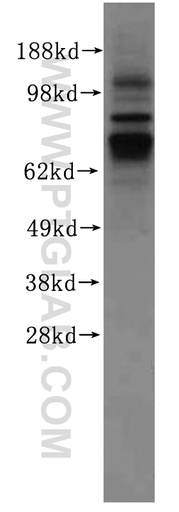 [17015-1-AP-20UL] FAM65B Polyclonal antibody