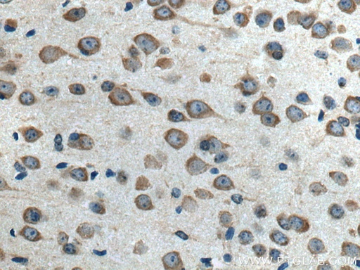 [17016-1-AP-20UL] ELP3 Polyclonal antibody