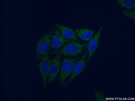 [17020-1-AP-20UL] PPM1F Polyclonal antibody