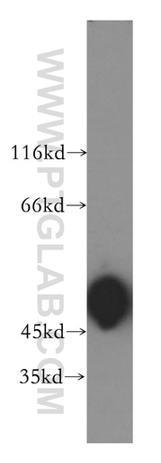 [17022-1-AP-150UL] ACTR3B Polyclonal antibody