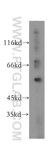 [17025-1-AP-150UL] NOC4L Polyclonal antibody