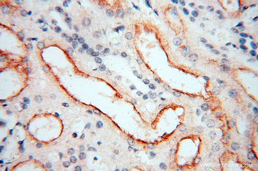 [17026-1-AP-150UL] GPR132 Polyclonal antibody
