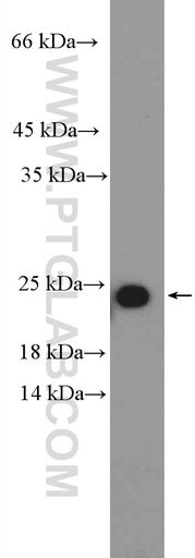 [17029-1-AP-150UL] RPL18 Polyclonal antibody