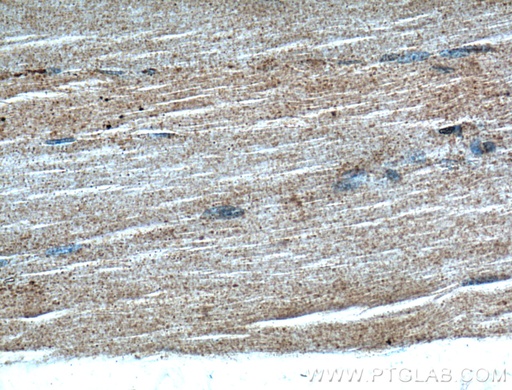 [17032-1-AP-150UL] GRK5 Polyclonal antibody