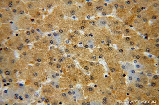 [17035-1-AP-20UL] GALT Polyclonal antibody