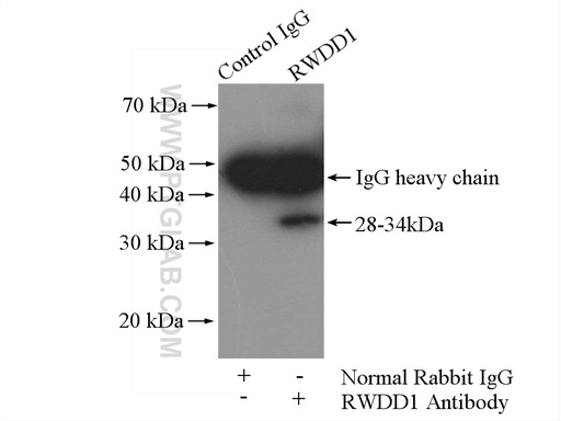 [17036-1-AP-150UL] RWDD1 Polyclonal antibody