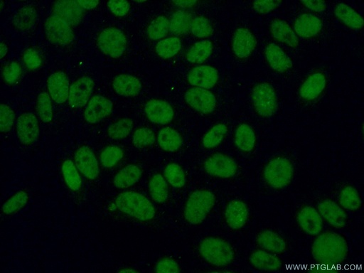 [17037-1-AP-20UL] CHAF1A Polyclonal antibody