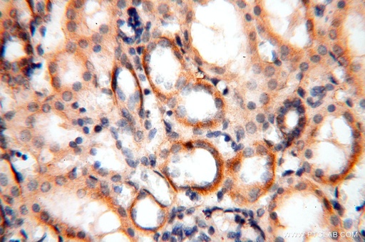 [17041-1-AP-20UL] MRPS11 Polyclonal antibody