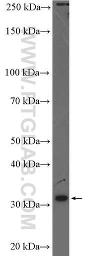 [17043-1-AP-150UL] DNAJC27 Polyclonal antibody