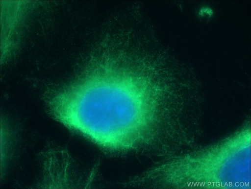 [17044-1-AP-20UL] CLIP4 Polyclonal antibody