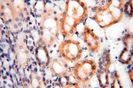 [17047-1-AP-20UL] ROGDI Polyclonal antibody