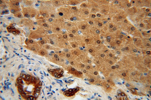[17048-1-AP-150UL] STARD10 Polyclonal antibody