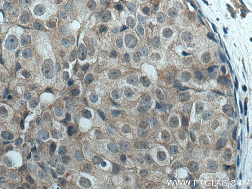 [17049-1-AP-150UL] LATS1 Polyclonal antibody