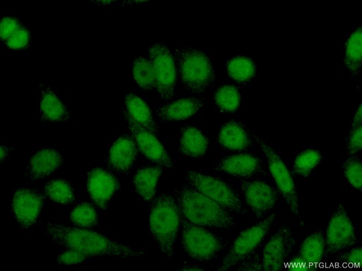 [17052-1-AP-150UL] GTF2IRD1 Polyclonal antibody