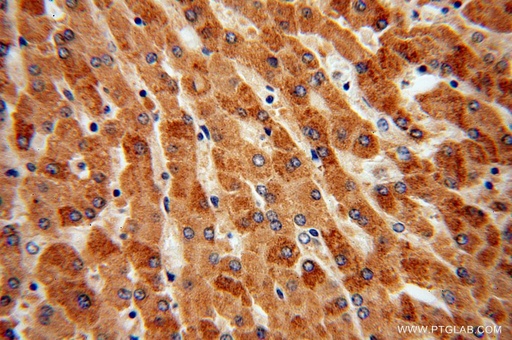 [17053-1-AP-20UL] TCTN2 Polyclonal antibody