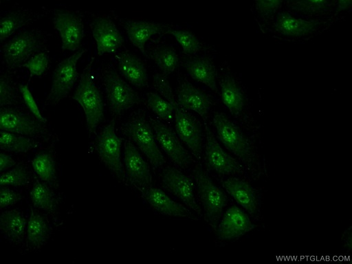 [17054-1-AP-150UL] INTS7 Polyclonal antibody