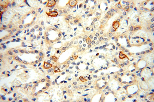 [17058-1-AP-20UL] TEKT4 Polyclonal antibody