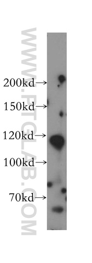 [17061-1-AP-150UL] PMFBP1 Polyclonal antibody