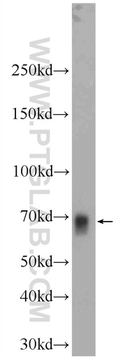 [17062-1-AP-20UL] NFE2L1 Polyclonal antibody