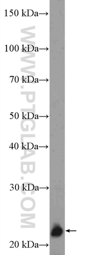 [17063-1-AP-150UL] ZNF22 Polyclonal antibody