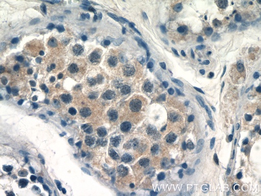 [17064-1-AP-20UL] CALR3 Polyclonal antibody