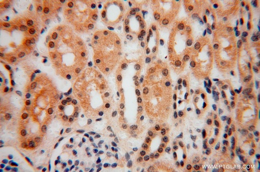 [17065-1-AP-150UL] SLFNL1 Polyclonal antibody