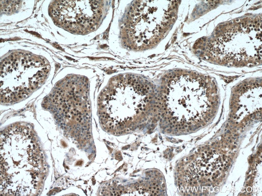 [17068-1-AP-20UL] TEX12 Polyclonal antibody