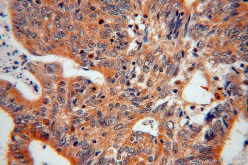 [17069-1-AP-20UL] EIF5A1/EIF5A2 Polyclonal antibody