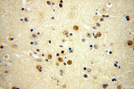 [17070-1-AP-150UL] ZNF18 Polyclonal antibody