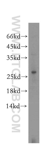 [17071-1-AP-20UL] DNAJB8 Polyclonal antibody