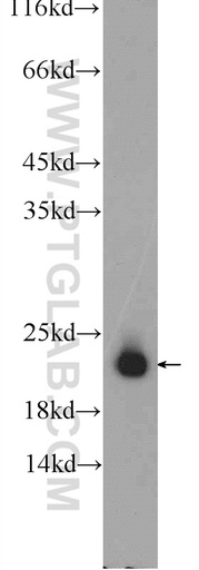 [17072-1-AP-20UL] SPANXB1 Polyclonal antibody