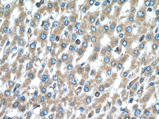 [17077-1-AP-20UL] PIP4K2C Polyclonal antibody