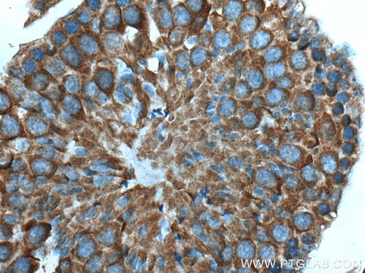[17078-1-AP-20UL] TBC1D5 Polyclonal antibody