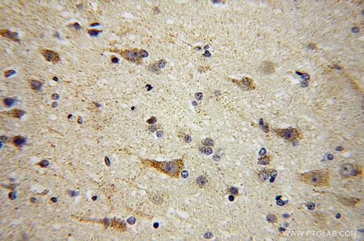 [17079-1-AP-150UL] AUH Polyclonal antibody