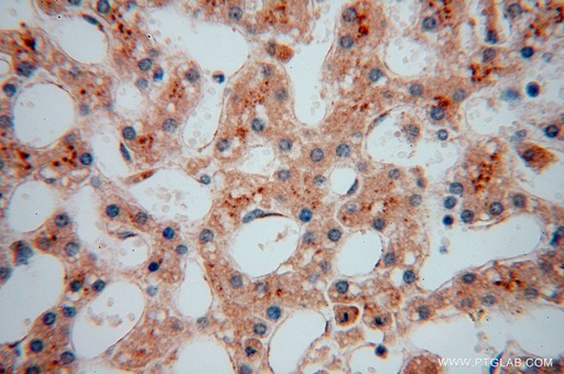 [17080-1-AP-20UL] PDLIM7 Polyclonal antibody