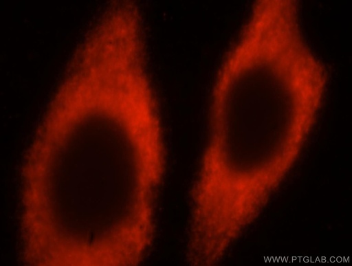 [17082-1-AP-150UL] RPL24 Polyclonal antibody